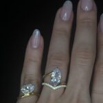 V Ring